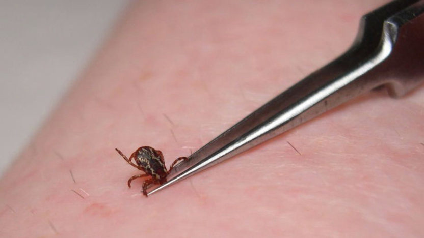 jak-vytahnout-kliste