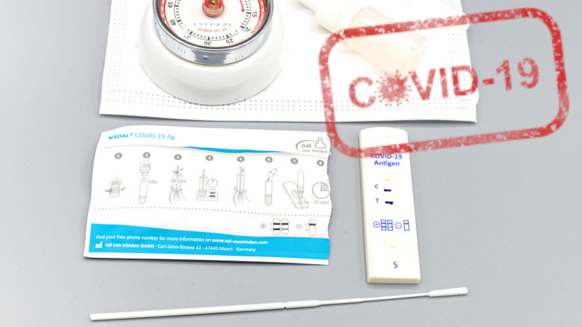 Jak a kde se objednat na antigenní test na Covid19